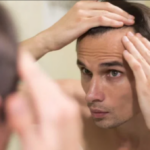 6 reasons 20-something guys lose hair and how to fix it 2023